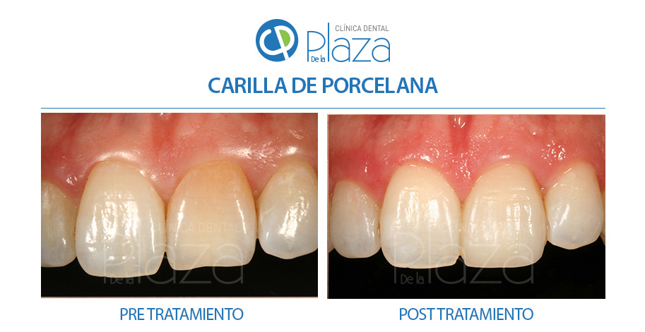 Dentista Madrid, Dentista Ventas, Clínica Dental Madrid, Clínica Dental Ventas.