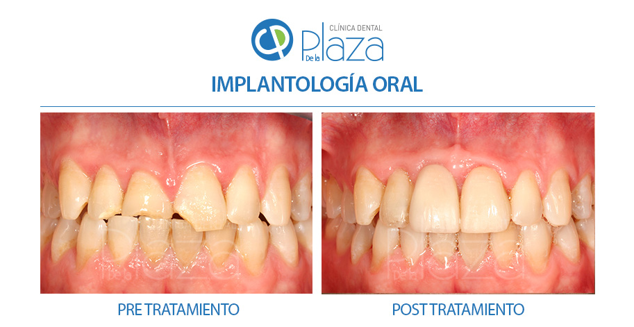 Dentista Madrid, Dentista Ventas, Clínica Dental Madrid, Clínica Dental Ventas.