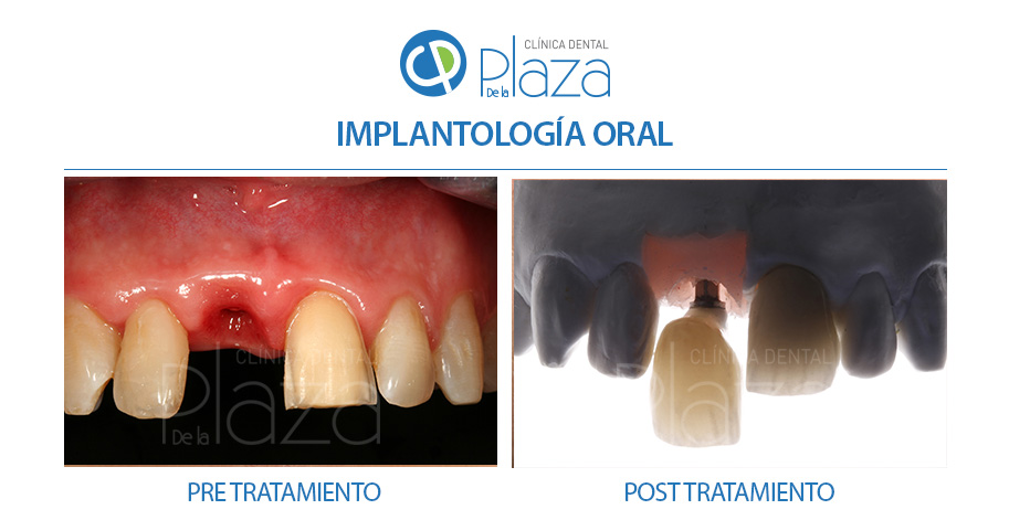 Dentista Madrid, Dentista Ventas, Clínica Dental Madrid, Clínica Dental Ventas.