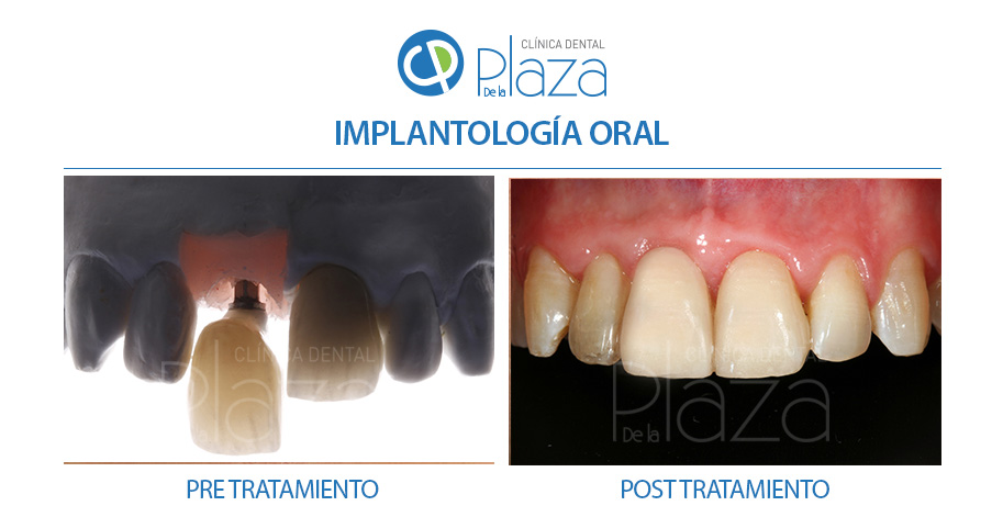 Dentista Madrid, Dentista Ventas, Clínica Dental Madrid, Clínica Dental Ventas.