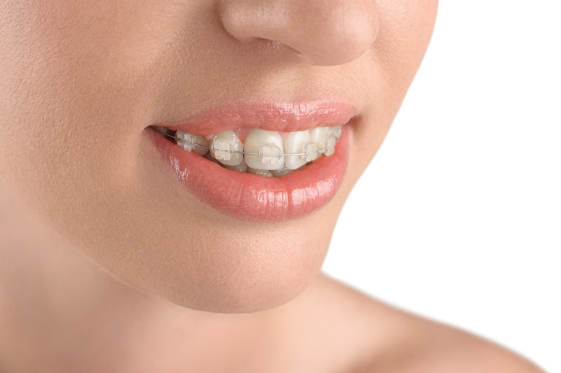 Dentista Madrid, Dentista Ventas, Clínica Dental Madrid, Clínica Dental Ventas.