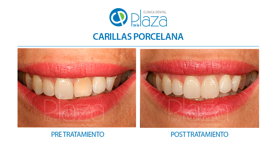 Dentista Madrid, Dentista Ventas, Clínica Dental Madrid, Clínica Dental Ventas.