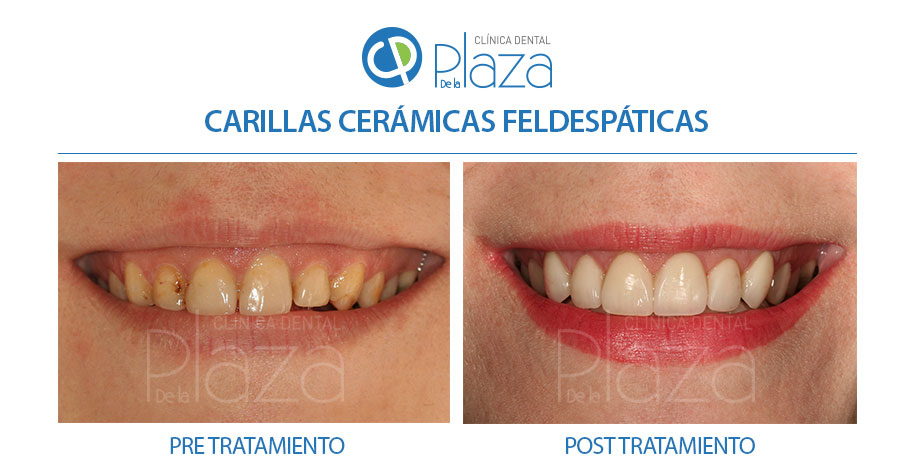 Dentista Madrid, Dentista Ventas, Clínica Dental Madrid, Clínica Dental Ventas.