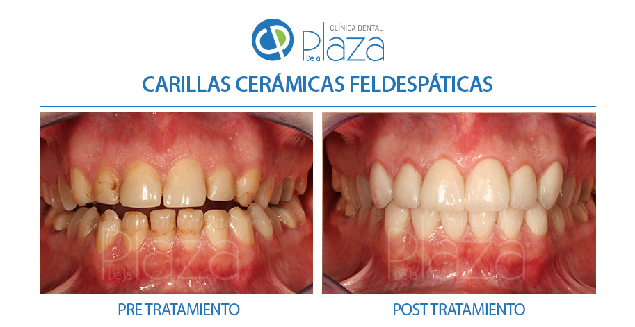 Dentista Madrid, Dentista Ventas, Clínica Dental Madrid, Clínica Dental Ventas.