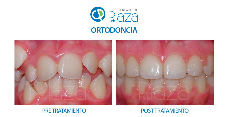Dentista Madrid, Dentista Ventas, Clínica Dental Madrid, Clínica Dental Ventas.
