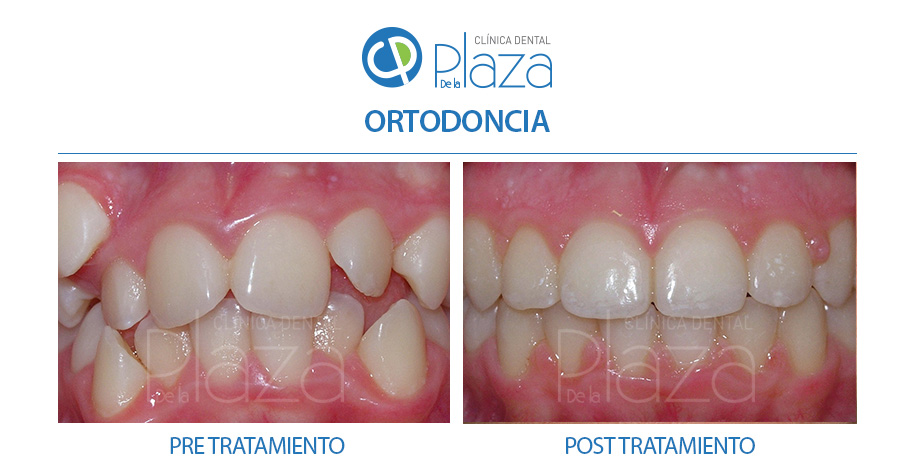 Dentista Madrid, Dentista Ventas, Clínica Dental Madrid, Clínica Dental Ventas.