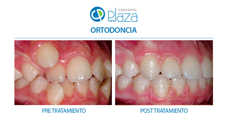 Dentista Madrid, Dentista Ventas, Clínica Dental Madrid, Clínica Dental Ventas.