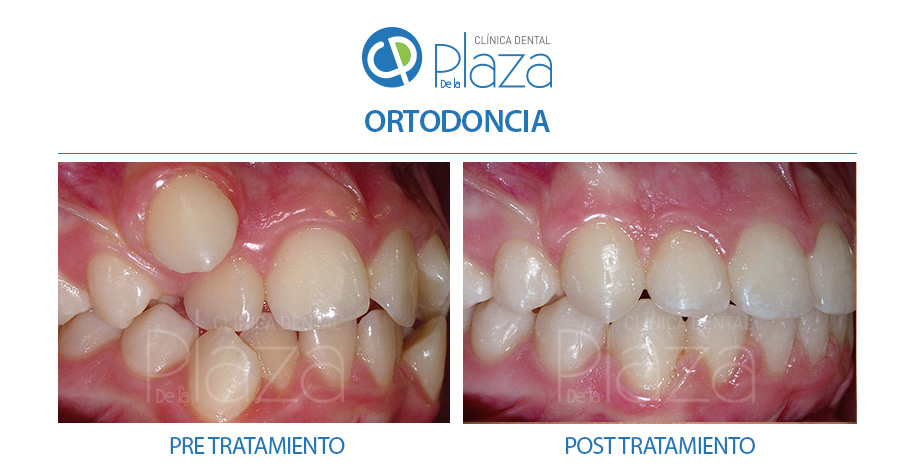 Dentista Madrid, Dentista Ventas, Clínica Dental Madrid, Clínica Dental Ventas.