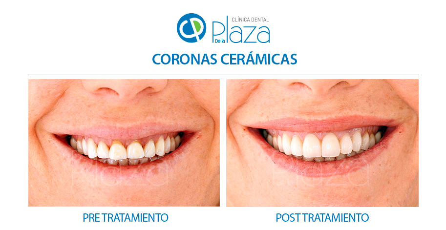 Dentista Madrid, Dentista Ventas, Clínica Dental Madrid, Clínica Dental Ventas.
