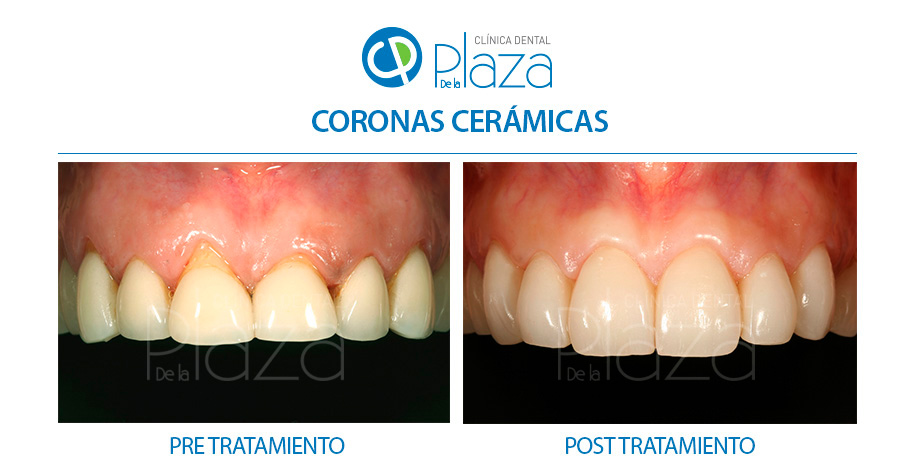 Dentista Madrid, Dentista Ventas, Clínica Dental Madrid, Clínica Dental Ventas.