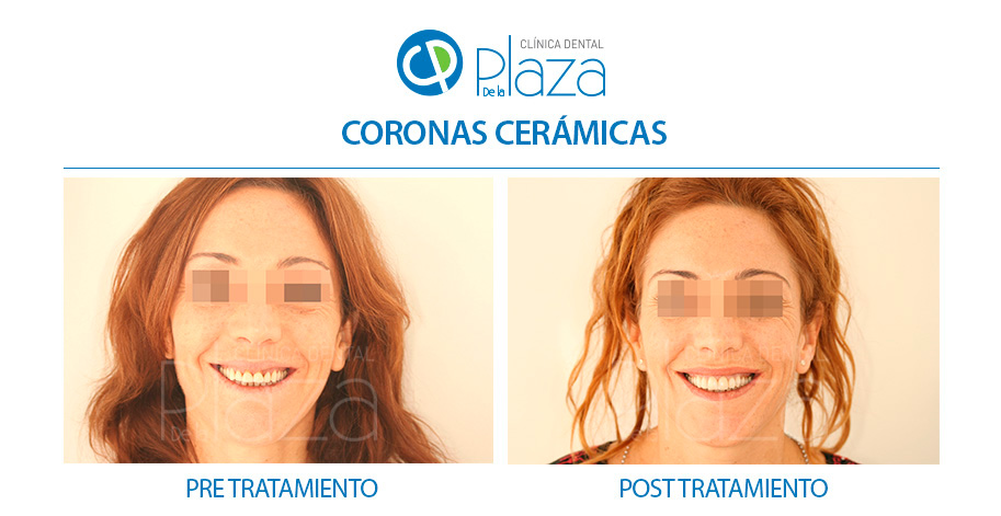 Dentista Madrid, Dentista Ventas, Clínica Dental Madrid, Clínica Dental Ventas.