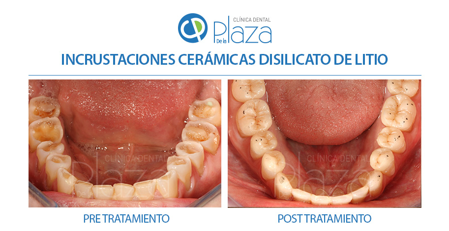 Dentista Madrid, Dentista Ventas, Clínica Dental Madrid, Clínica Dental Ventas.