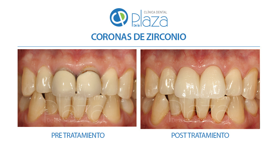 Dentista Madrid, Dentista Ventas, Clínica Dental Madrid, Clínica Dental Ventas.