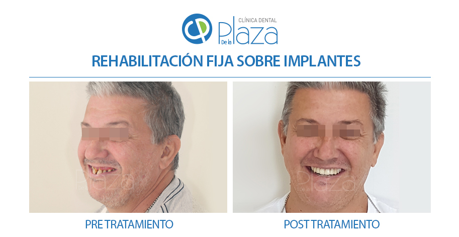 Dentista Madrid, Dentista Ventas, Clínica Dental Madrid, Clínica Dental Ventas.