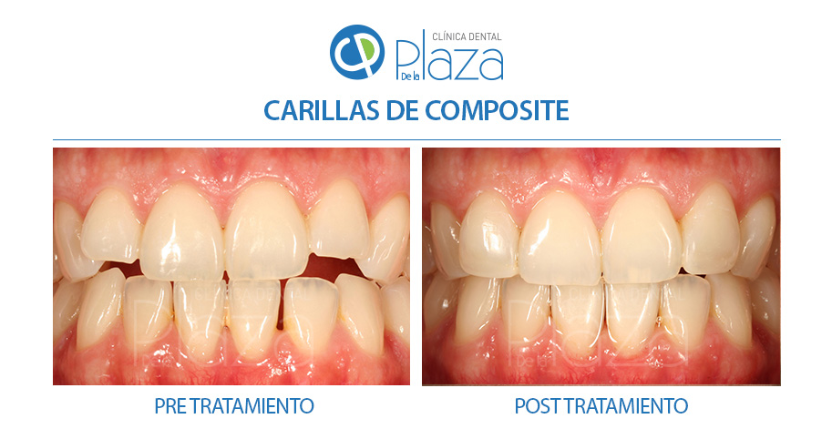 Dentista Madrid, Dentista Ventas, Clínica Dental Madrid, Clínica Dental Ventas.