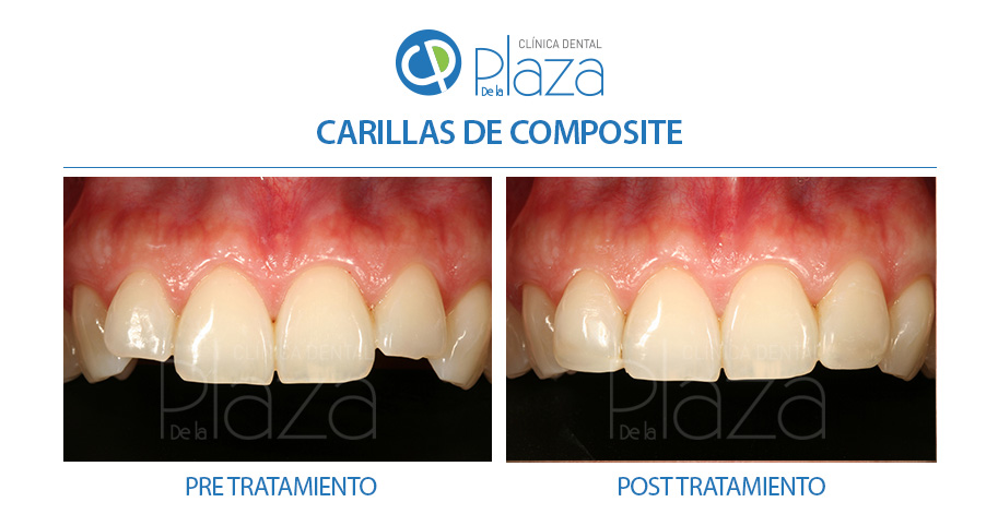 Dentista Madrid, Dentista Ventas, Clínica Dental Madrid, Clínica Dental Ventas.
