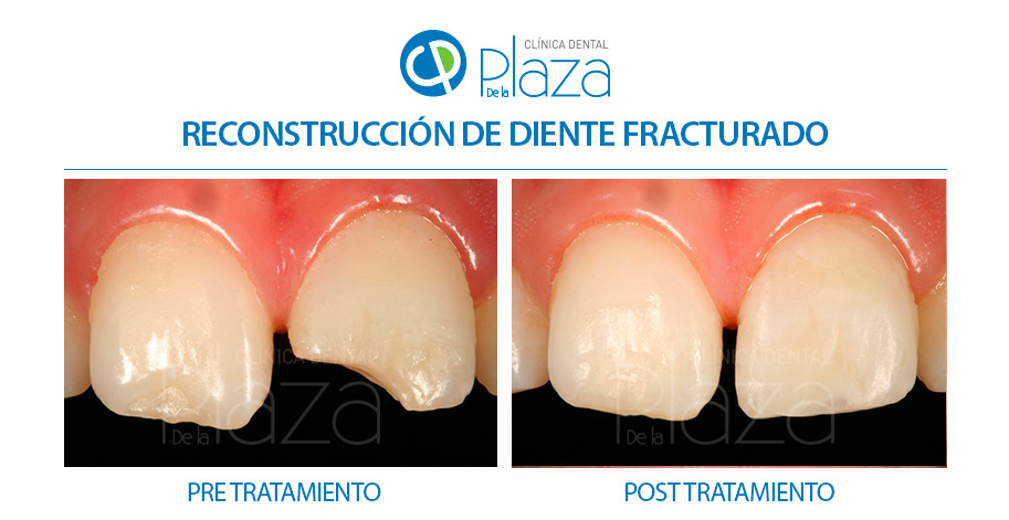 Dentista Madrid, Dentista Ventas, Clínica Dental Madrid, Clínica Dental Ventas.