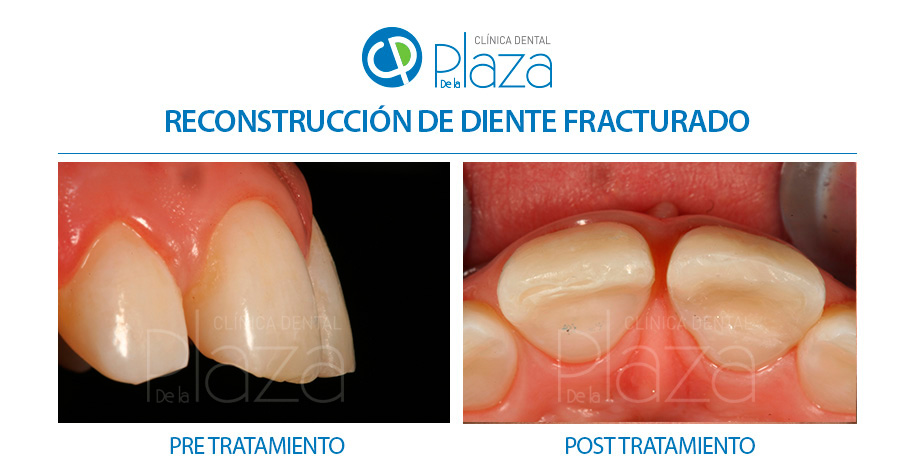 Dentista Madrid, Dentista Ventas, Clínica Dental Madrid, Clínica Dental Ventas.