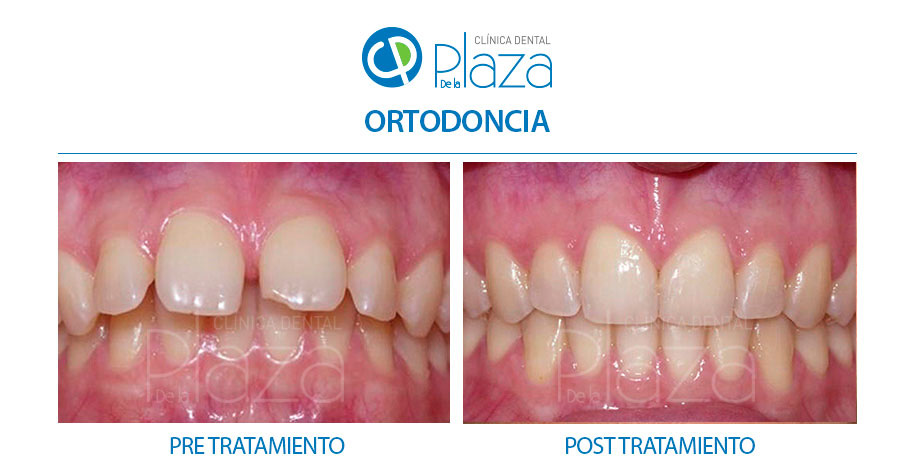 Dentista Madrid, Dentista Ventas, Clínica Dental Madrid, Clínica Dental Ventas.