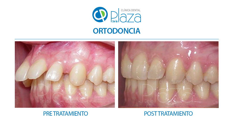 Dentista Madrid, Dentista Ventas, Clínica Dental Madrid, Clínica Dental Ventas.
