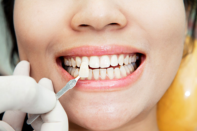 Dentista Madrid, Dentista Ventas, Clínica Dental Madrid, Clínica Dental Ventas.