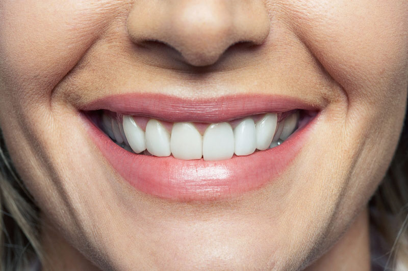 Dentista Madrid, Dentista Ventas, Clínica Dental Madrid, Clínica Dental Ventas.