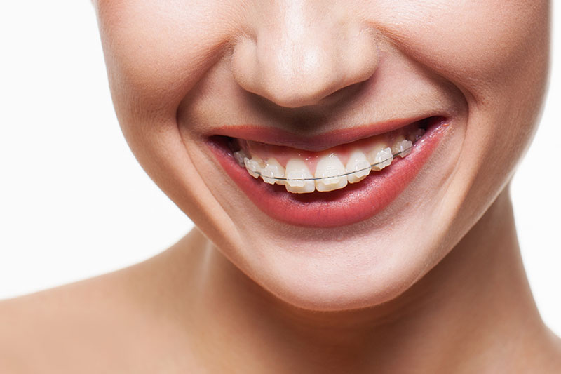 Dentista Madrid, Dentista Ventas, Clínica Dental Madrid, Clínica Dental Ventas.