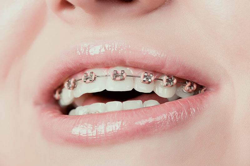 Dentista Madrid, Dentista Ventas, Clínica Dental Madrid, Clínica Dental Ventas.