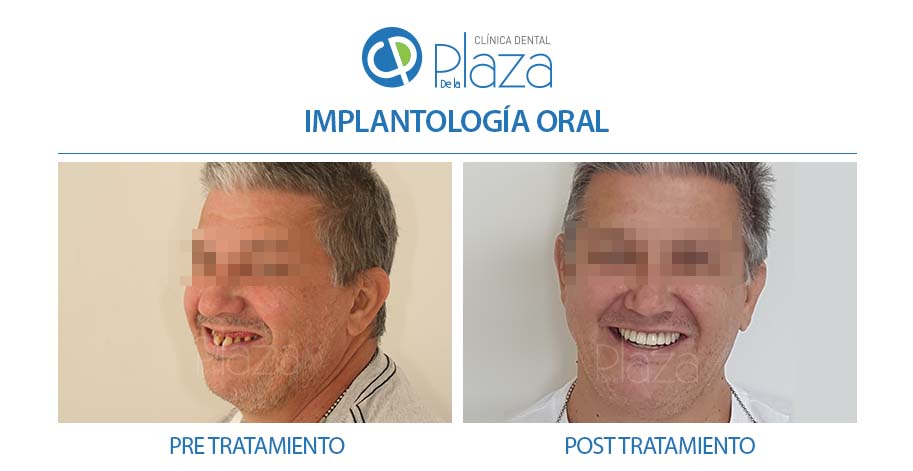Dentista Madrid, Dentista Ventas, Clínica Dental Madrid, Clínica Dental Ventas.