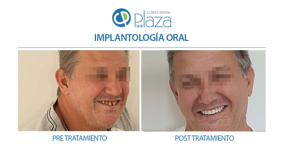 Dentista Madrid, Dentista Ventas, Clínica Dental Madrid, Clínica Dental Ventas.