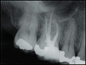 Dentista Madrid, Dentista Ventas, Clínica Dental Madrid, Clínica Dental Ventas.