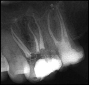 Dentista Madrid, Dentista Ventas, Clínica Dental Madrid, Clínica Dental Ventas.