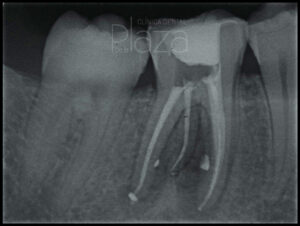 Dentista Madrid, Dentista Ventas, Clínica Dental Madrid, Clínica Dental Ventas.