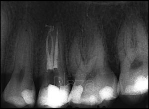 Dentista Madrid, Dentista Ventas, Clínica Dental Madrid, Clínica Dental Ventas.